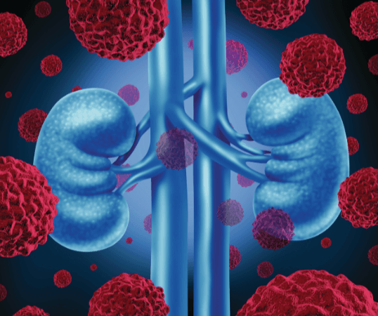 Observational Study Confirms Safety Profile of Biosimilar Epoetin Alfa in Nephrology